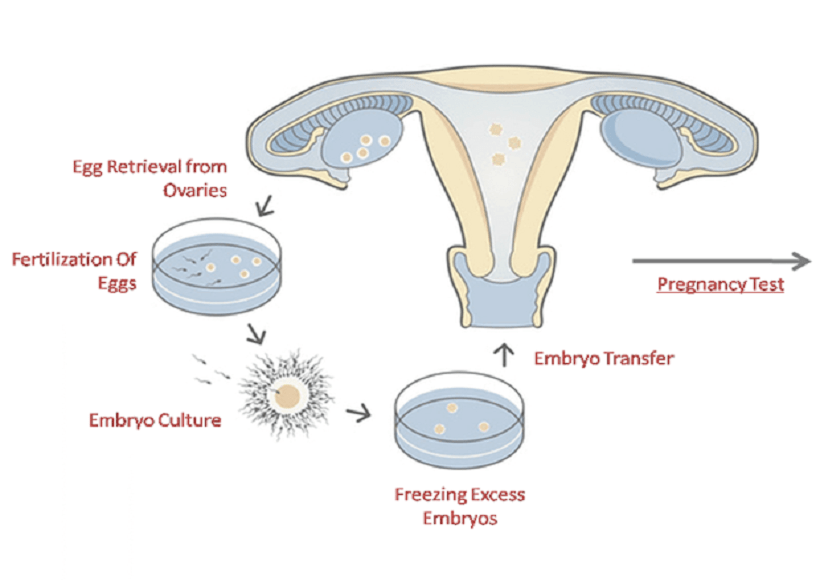 Is IVF Treatment Expensive in Jaipur?