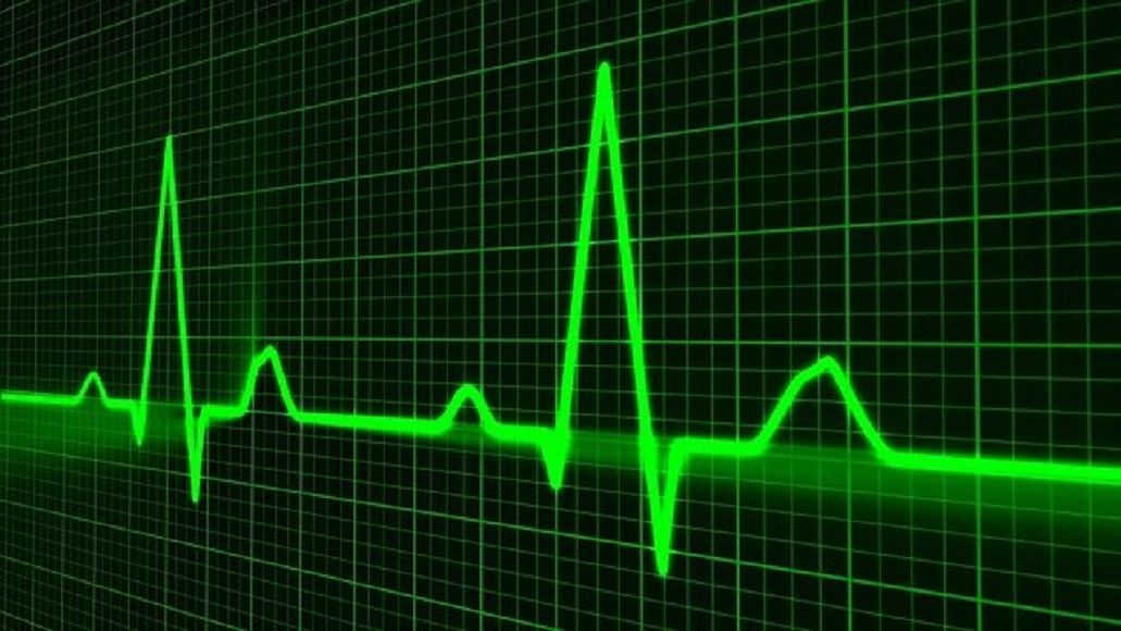 Vibration Analysis: All You Need to Know vibration monitoring